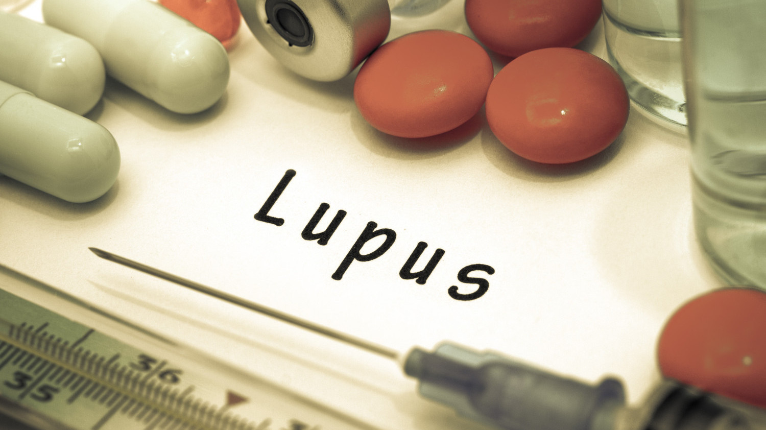Новые клинические рекомендации по СКВ: шаг к управлению заболеванием