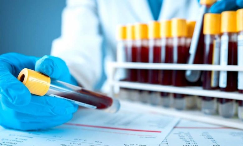 Ученые нашли в крови долгожителей 37 белков замедляющих старение